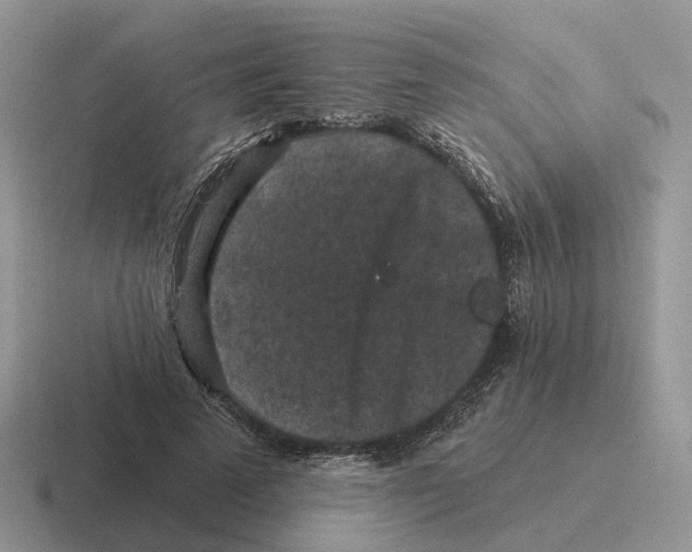 X0000116570689201001071155