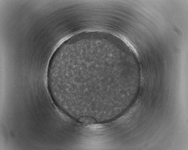 X0000116570845201001071153