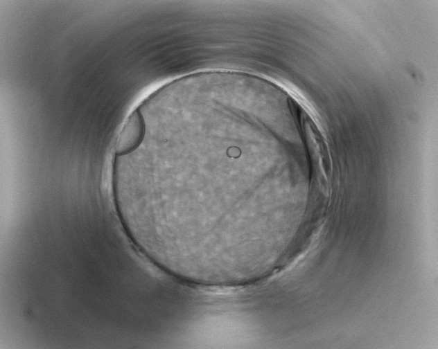 X0000116570862201001071153