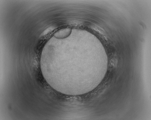 X0000116570869201001071153