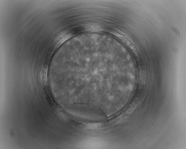 X0000116570889201001071152