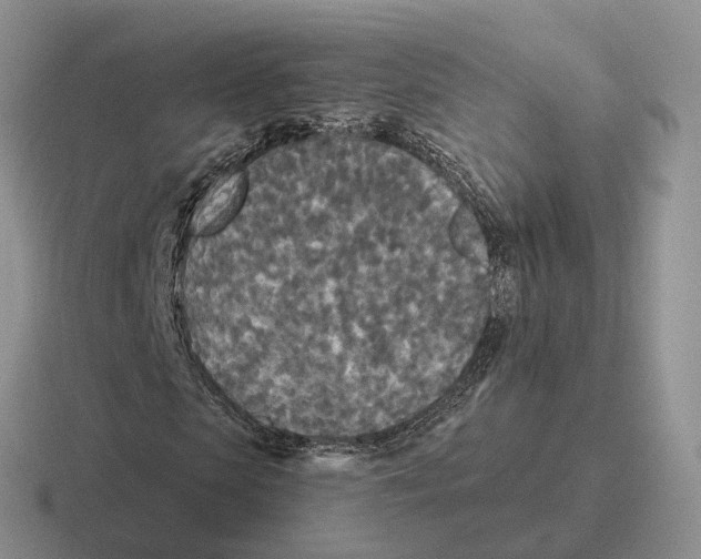 X0000116570913201001071151