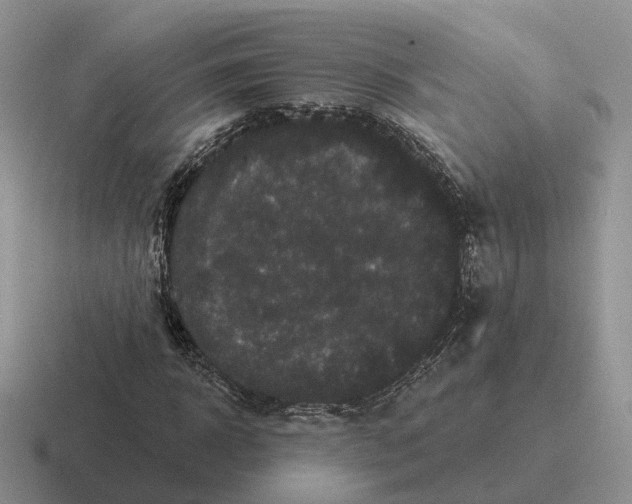 X0000116570918201001071151