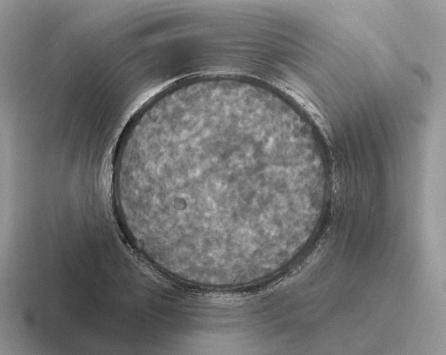 X0000116570933201001071152