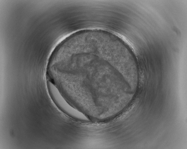 X0000116570943201001071152