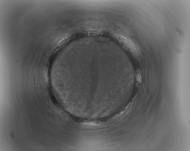 X0000116571252201001071148