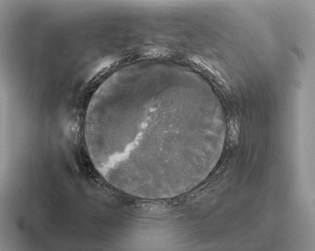 X0000116571254201001071148