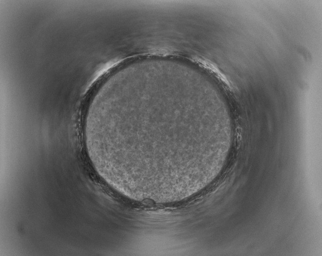 X0000116571256201001071148