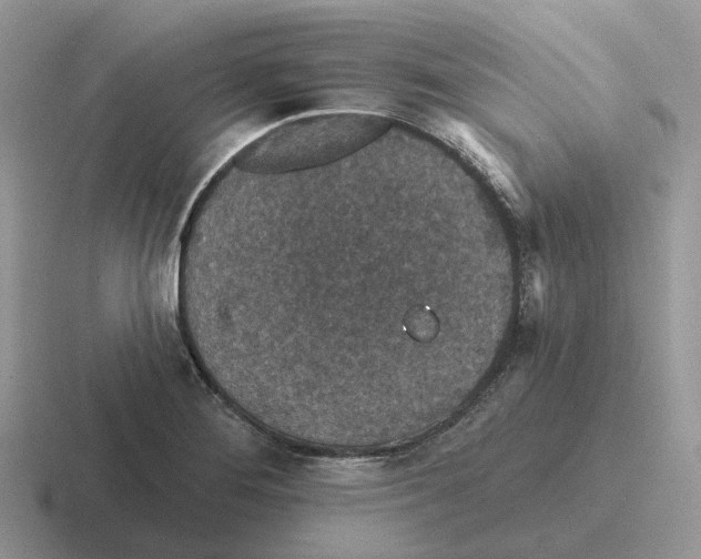 X0000116571276201001071147