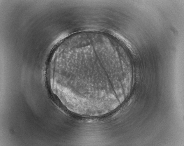 X0000116571411201001071146