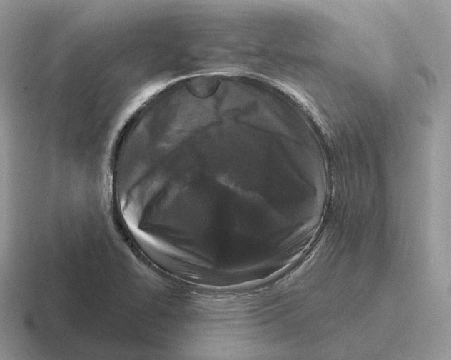 X0000116571414201001071146