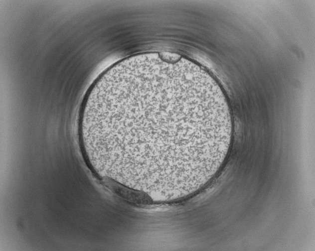 X0000116571426201001071146