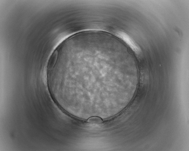 X0000116571468201001071145