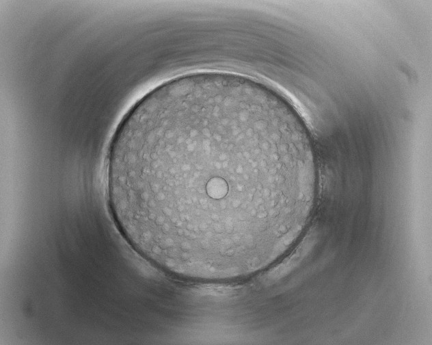 X0000116571514201001071144