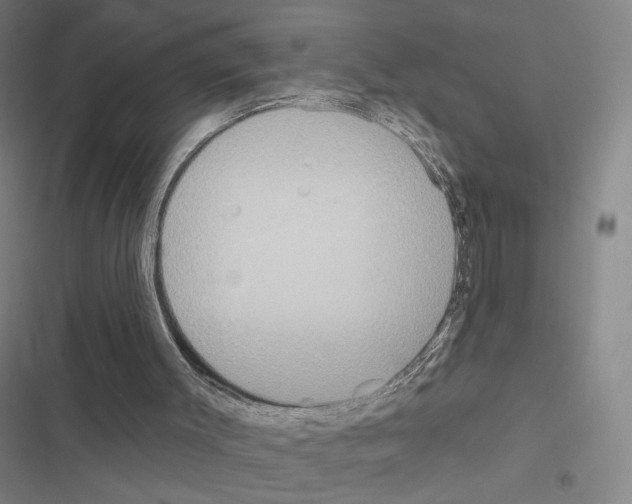 X0000116570003201001211253