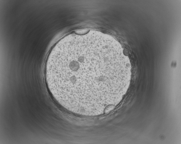 X0000116570004201001211253