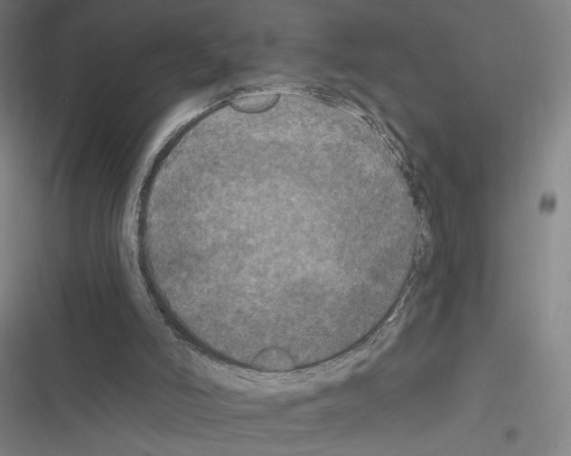 X0000116570006201001211253