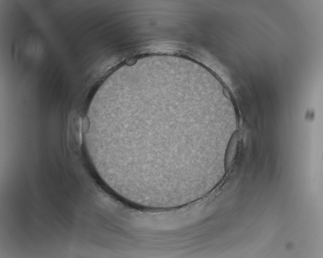 X0000116570013201001211253