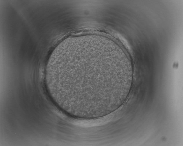 X0000116570017201001211253