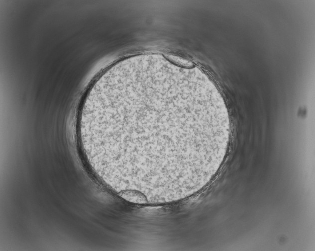 X0000116570054201001211252