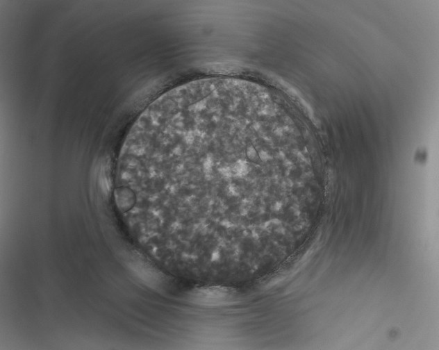 X0000116570069201001211252