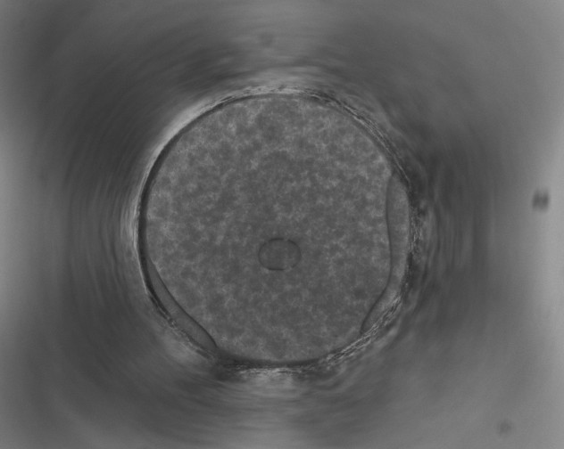 X0000116570100201001211252