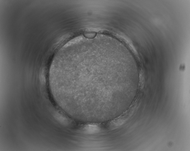 X0000116570114201001211252