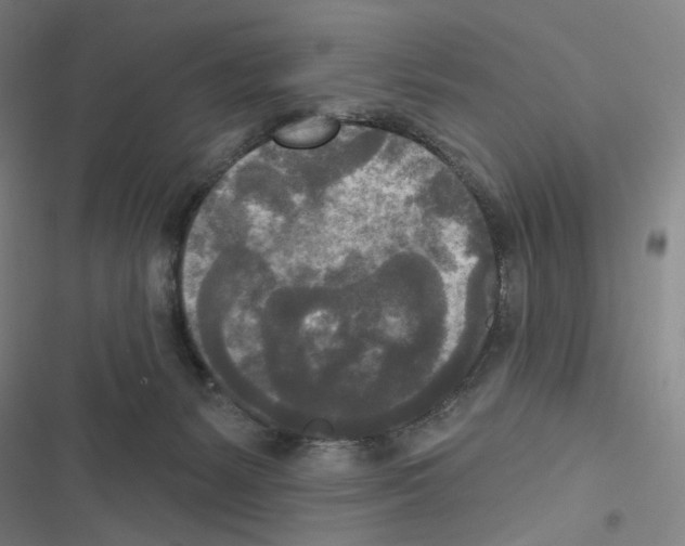 X0000116570127201001211252