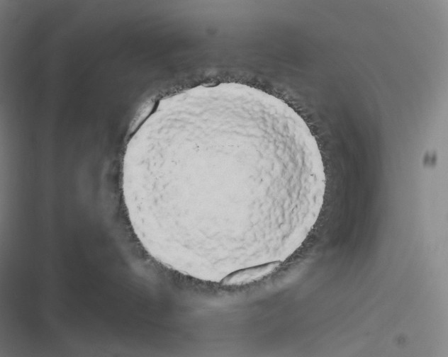 X0000116570144201001211251