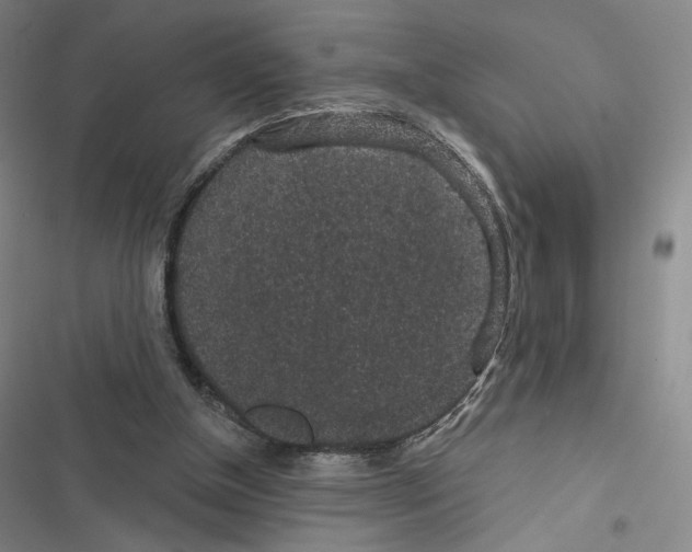 X0000116570154201001211251