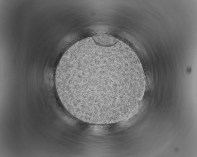 X0000116570187201001211251