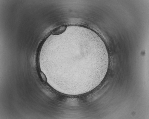 X0000116570203201001211250