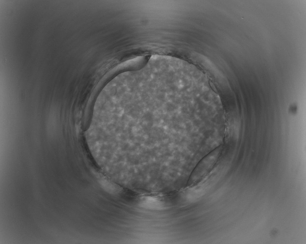 X0000116570285201001211250