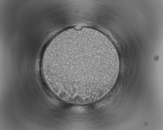 X0000116570299201001211249