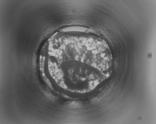 X0000116570303201001211249