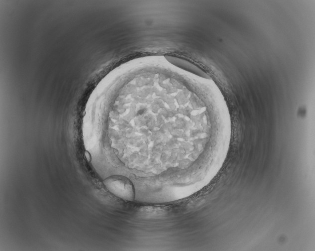 X0000116570354201001211248