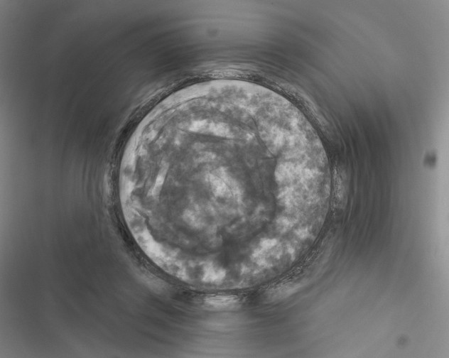 X0000116570357201001211248