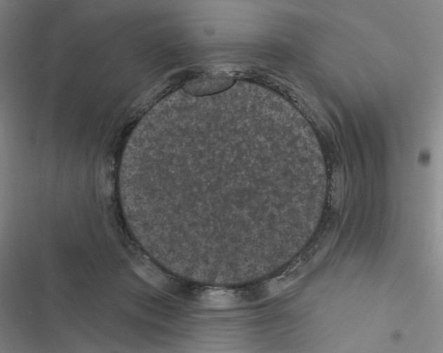 X0000116570413201001211248