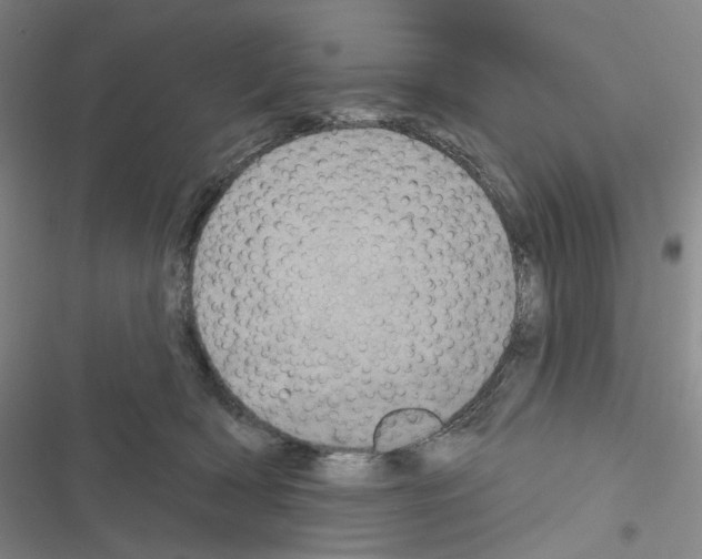 X0000116570418201001211248