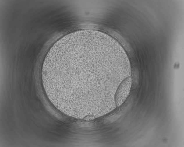 X0000116570433201001211247