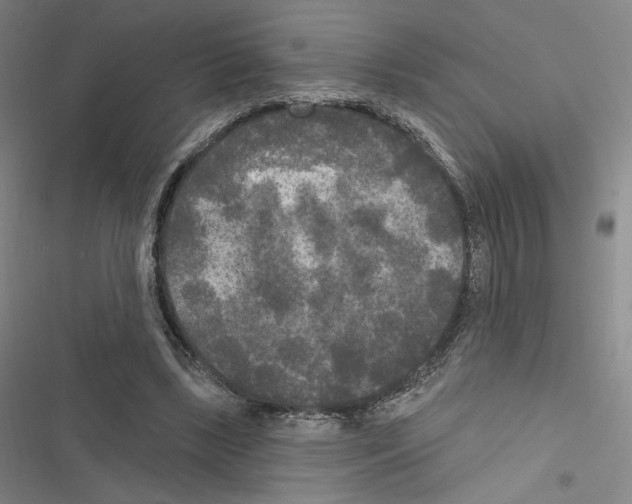 X0000116570443201001211247