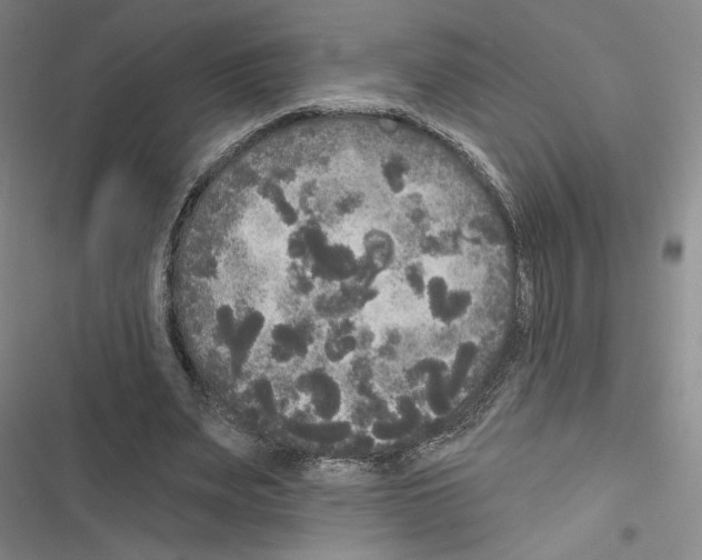 X0000116570487201001211247