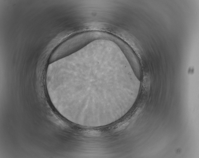 X0000116570577201001211245