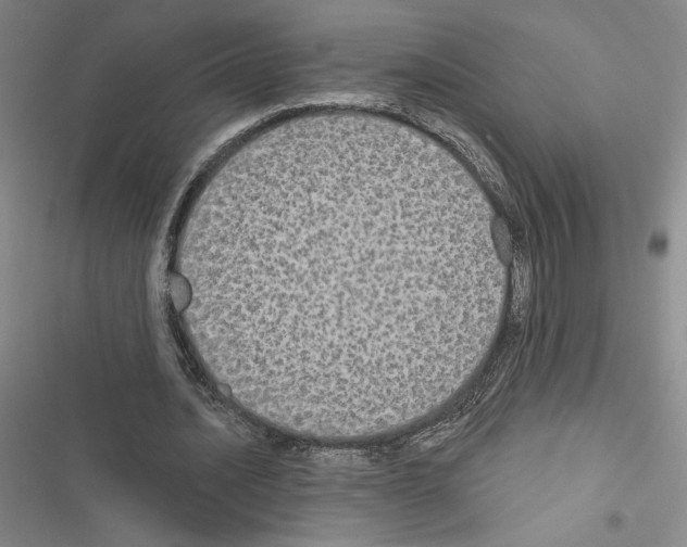 X0000116570628201001211244