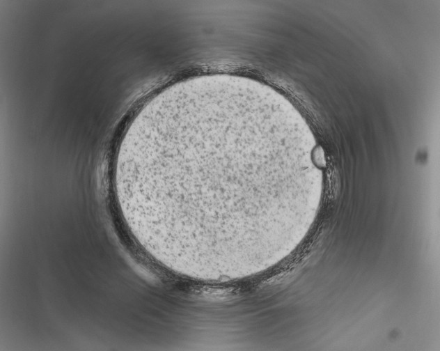 X0000116570638201001211244