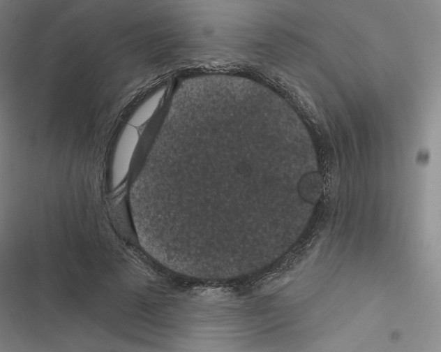 X0000116570689201001211244