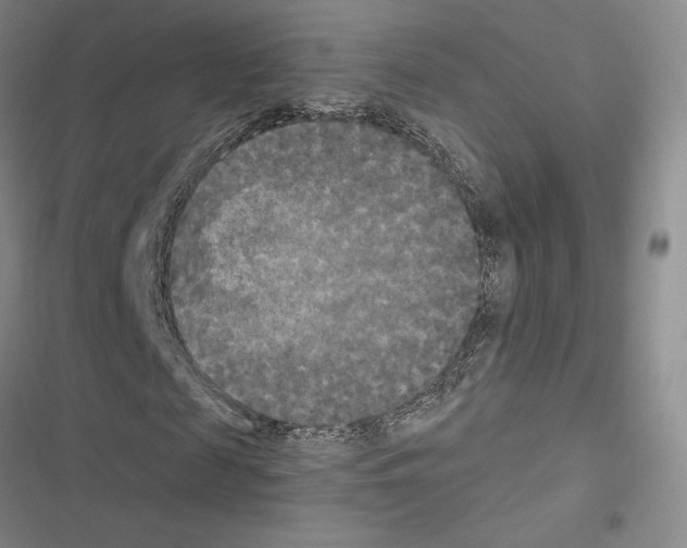 X0000116570817201001211241