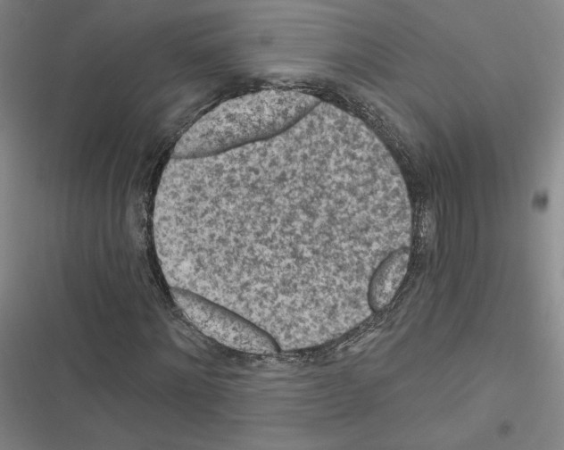 X0000116570868201001211241