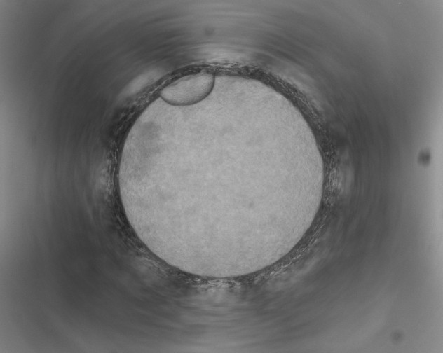 X0000116570869201001211241