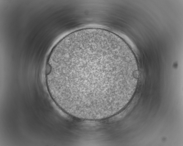 X0000116570910201001211241